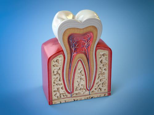 root canal doreen vic