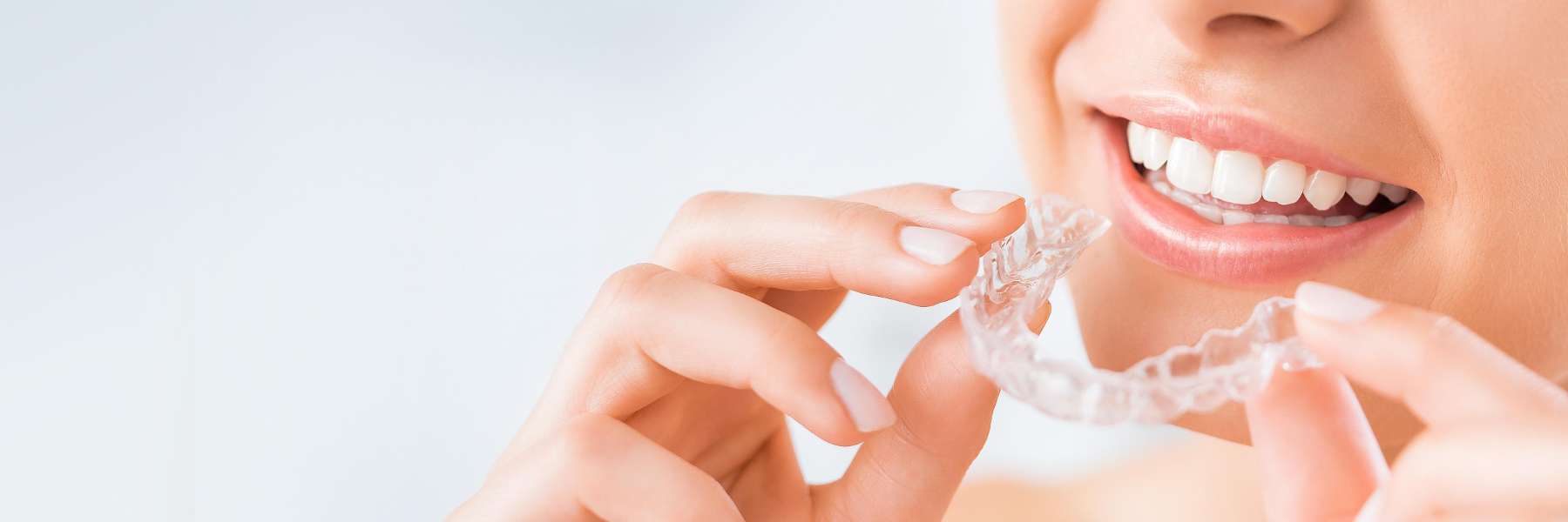 patient putting in clear aligners in doreen