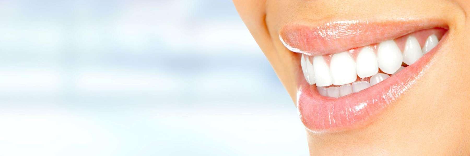 patient after using teeth whitening in Doreen