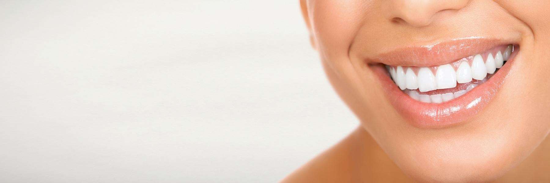 veneers doreen vic