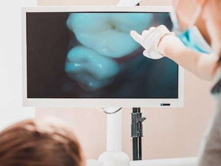 intraoral camera doreen vic